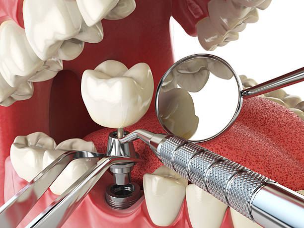 Best Emergency Orthodontic Repairs in Williamsburg, VA